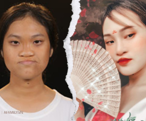 Từng nghĩ đến cái chết vì dị tật sứt môi, hở hàm ếch, nữ sinh Phú Thọ mạnh mẽ trải qua 6 lần dao kéo và có màn lột xác vô cùng đỉnh cao