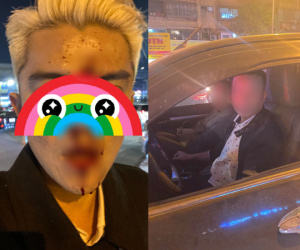Hà Nội: Xôn xao nam thanh niên bị đánh gãy răng, chảy máu mũi do nhắc nhở tài xế dừng xe quá lâu gây tắc đường