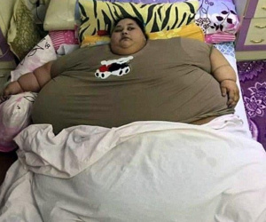 Người phụ nữ béo nhất thế giới nặng 500kg, xe tải cỡ lớn hộ tống tới bệnh viện để phẫu thuật giảm được 300kg nhưng vẫn đón nhận cái kết bi thảm