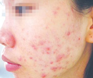 Sát Tết, lại khổ vì mỹ phẩm giả