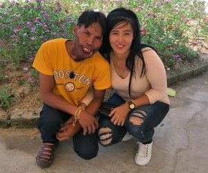 Chàng trai 'mặt quỷ' nên duyên, thề non hẹn biển với người vợ xinh đẹp giờ có cuộc sống ra sao sau 2 năm?