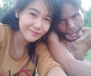 Cuộc hôn nhân không như mơ của chàng trai 'mặt quỷ' và 'vợ tiên'