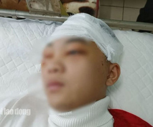 Nam sinh lớp 11 bị đánh vỡ sọ não chuyển viện tiếp tục điều trị
