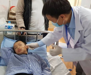 Hà Nội: Bé trai 8 tuổi bị chó béc-giê nhà bà nuôi cắn rách mặt và môi