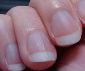 Người đàn ông đột ngột phát hiện ung thư phổi, BS nhắc nhở: 4 dấu hiệu này trên tay nghĩa là ung thư đã đến giai đoạn giữa và cuối