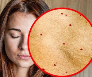 Đang ở độ tuổi đôi mươi mà thấy 8 dấu hiệu trên khuôn mặt thì hãy coi chừng bạn đang bắt đầu già đi nhanh chóng