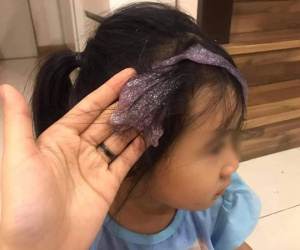 Bé gái nghịch dại khiến 'chất nhầy ma quái' ôm trọn mái tóc, mẹ trẻ vội vàng lên mạng cầu cứu cách loại bỏ và nhận về 1 rổ kinh nghiệm