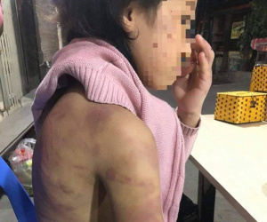 Hà Nội: Bố bàng hoàng khi biết con gái 12 tuổi nghi bị mẹ bạo hành, người tình của mẹ xâm hại nhiều lần