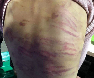 Cháu bé nghi bị mẹ đánh đập, người tình của mẹ xâm hại nhiều lần: 'Cháu chỉ ước không phải về ngôi nhà đó sống nữa'