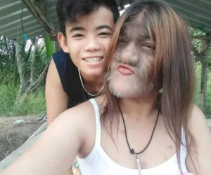 Cô bé 'người sói' từng nổi tiếng thế giới vì toàn thân phủ đầy lông gây bất ngờ với diện mạo hiện tại và cuộc sống hạnh phúc bên bạn trai