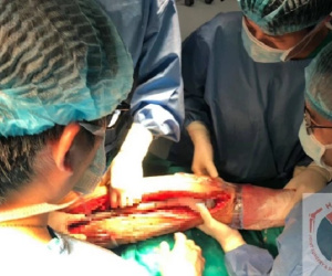 Ca phẫu thuật thay xương đùi cho bệnh nhân nhỏ tuổi nhất Việt Nam, thứ 2 thế giới