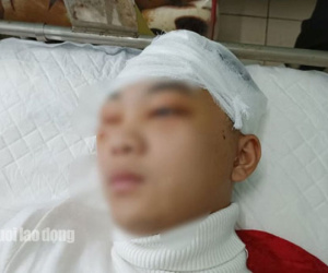 Khởi tố, bắt giam nam sinh lớp 11 đánh bạn học vỡ sọ não