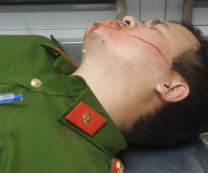 Hai chiến sĩ công an bị chém khi khống chế đối tượng dọa giết người