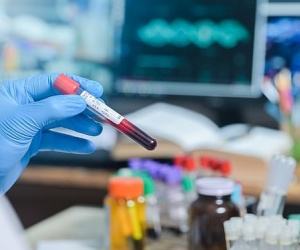Phát hiện người thứ hai tự khỏi HIV