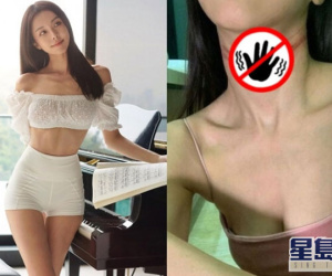 'Bom sex Malaysia' đăng ảnh tự tử thất bại
