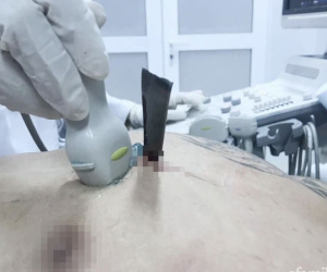 Cãi nhau với bạn gái, chàng trai 19 tuổi tự cầm dao đâm thủng tim