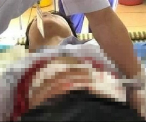 Xô xát trong lúc trêu đùa, nam sinh lớp 9 đâm bạn trọng thương