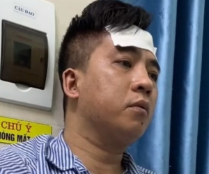 Bắt nghi can giết người tình trong khách sạn
