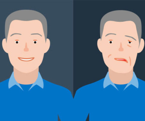 Dấu hiệu nhận biết người bị đột quỵ qua nụ cười
