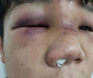 Thái Nguyên: Học sinh mâu thuẫn, phụ huynh hành hung bạn của con