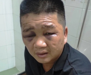 Rút tiền bỏ vào cốp xe, chủ nhà hàng gặp phải 'bọn ác'