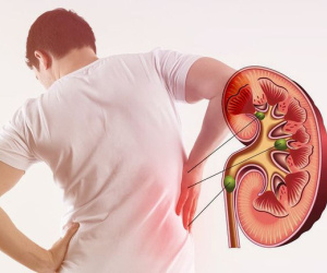 Phát hiện thay đổi rõ ràng ở 4 bộ phận này trên cơ thể, nên đi kiểm tra thận gấp