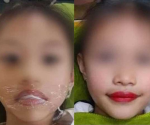 Đại diện thẩm mỹ viện phun môi cho bé gái 5 tuổi lên tiếng: 'Con gái là ngọc ngà trong nhà nên đâu có chuyện làm những gì không tốt cho bé'
