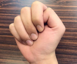 Đây là 3 cách kiểm tra cực nhanh giúp bạn biết được mình có nguy cơ bị tắc nghẽn mạch máu hay không?
