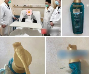 Trượt ngã trong nhà tắm bị chai dầu gội đầu cắm vào mông, cô gái trẻ cố rút ra rồi... nhập viện do rách hậu môn