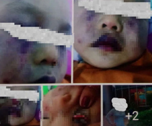 Nghi vấn điểm giữ trẻ không phép bạo hành dã man trẻ 18 tháng tuổi