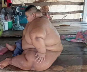 Bi kịch của cậu bé béo nhất Thái Lan: 13 tuổi đã nặng 200kg, từ bé bị ép ăn cho 'chóng lớn' và hậu quả đáng thương gây ám ảnh
