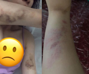 Bị bạn gái chia tay vì không hợp, thanh niên đập cửa từng nhà tìm rồi đánh đập thậm tệ: 'Tao bắt mày phải yêu tao cho tới khi tao có bồ mới!'