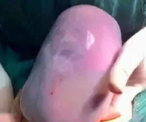 Thấy con chào đời, bố sợ không dám bế nhưng bác sĩ lại chúc mừng