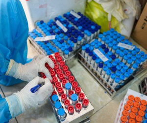 Nóng: Bắc Giang phát hiện 375 ca Covid-19 mới, một công ty có 79% F1 dương tính