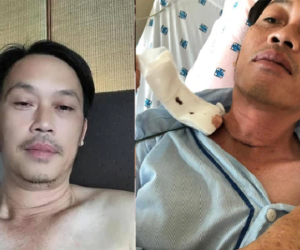 Hoài Linh vừa lộ chuyện bị K tuyến giáp, dân mạng lập tức chỉ ra sự bất nhất vào ngày nam nghệ sĩ phẫu thuật, tuy nhiên câu trả lời cuối cùng sẽ khiến nhiều người phải suy nghĩ lại