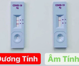 Bộ Y tế cảnh báo sử dụng test nhanh SARS-CoV-2 bán trên mạng