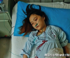 Cô gái 28 tuổi qua đời vì ung thư gan sau 5 tháng phát hiện bệnh, bác sĩ cảnh báo khi cơ thể 'có mùi' ở 3 nơi nên đi kiểm tra gan càng sớm càng tốt