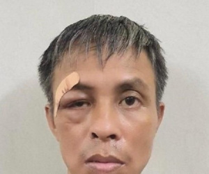 Đâm bệnh nhân nằm bên cạnh vì buồn chán