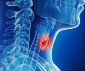 3 loại ung thư có thể phát tín hiệu ở cổ họng? Nếu thấy các triệu chứng bất thường này cần đến ngay cơ quan y tế