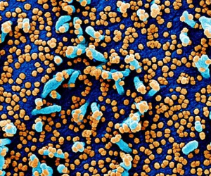Phát hiện 2 con virus 'anh em' với Covid-19: 'Quái vật' 4 trong 1, nhảy từ động vật sang người