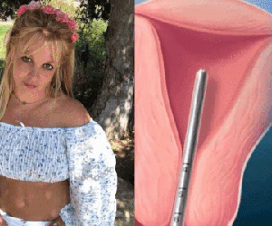 Phương pháp tránh thai mà người giám hộ ép Britney Spears phải dùng, không cho cô sinh thêm con là gì?