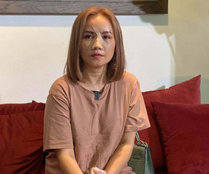 Hoàng Yến băng bó mặt, sợ hãi: 'Tôi bật dậy thì thấy anh ta cầm con dao dí vào mặt mình'