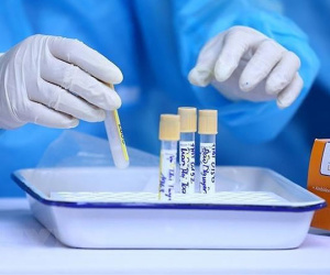 5 nhóm người được chi trả phí xét nghiệm nCoV