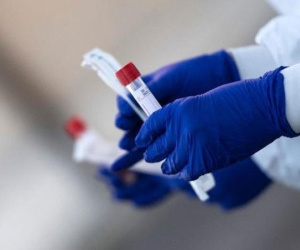 TP.HCM: Dự kiến triển khai 200.000 xét nghiệm kháng nguyên nhanh virus SARS-COV-2 trong 1 ngày