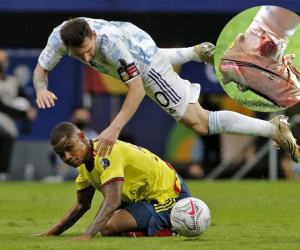 Chân rướm máu, Messi vẫn đưa Argentina vào chung kết Copa America