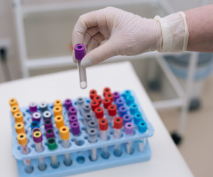 Đại học Oxford chính thức thử nghiệm vaccine HIV, chấm dứt 40 năm chờ đợi