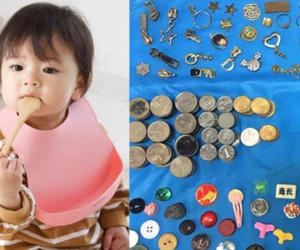 3.000 dị vật được bác sĩ gắp ra từ trong bụng của trẻ nhỏ, rất nhiều thứ bạn chẳng bao giờ có thể ngờ tới