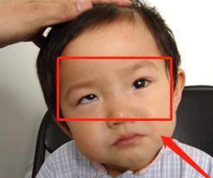 Bé trai 5 tuổi mắt thâm đen, con ngươi 1 bên gần như biến mất, tất cả chỉ vì thói quen độc hại này