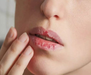 Ở nhà ngồi điều hòa nhiều dễ gây khô môi lắm, chị em nhớ sắm son dưỡng kẻo môi lại khô như sa mạc