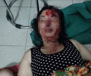 Hải Dương: Điều tra vụ vợ tố chồng chích điện, dìm xuống ao lúc nửa đêm